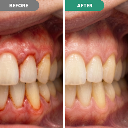 Gum Repair Gel